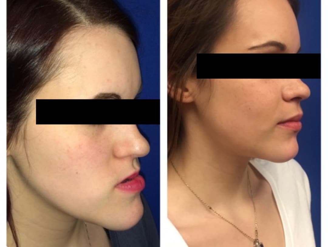 Orthognathic / Facial Cosmetic Surgery
